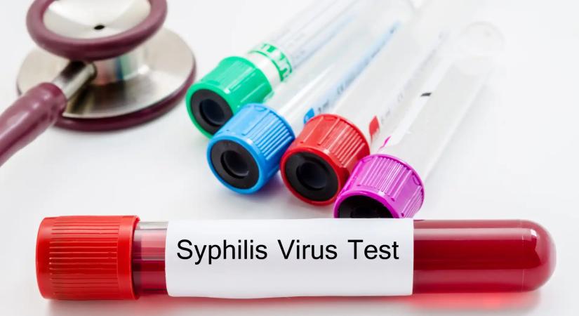 Országos szűrőprogram indul a szifilisz terjedése miatt Magyarországon: egyre több csecsemő születik a betegséggel