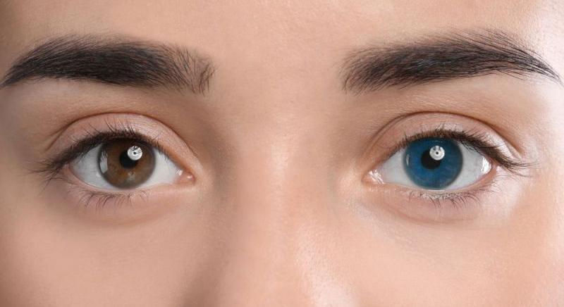 Eltérő színű a két szeme Emma Watsont mexikói milliárdosának