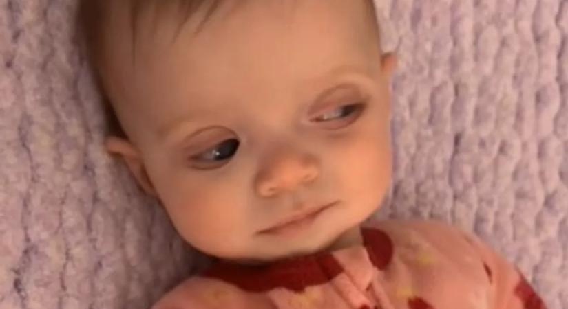 Boldog pillanatból rémálom: ritka szembetegséggel diagnosztizálták az újszülöttet