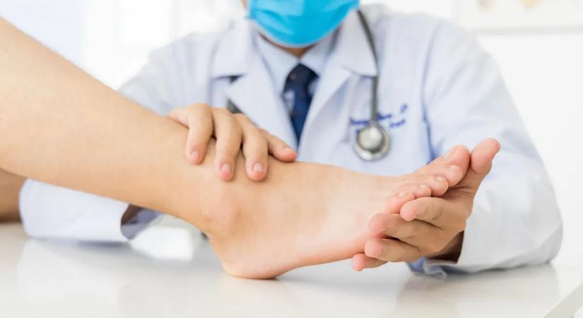 Bütyök nehezíti a járásod? Ekkor van szükség műtétre