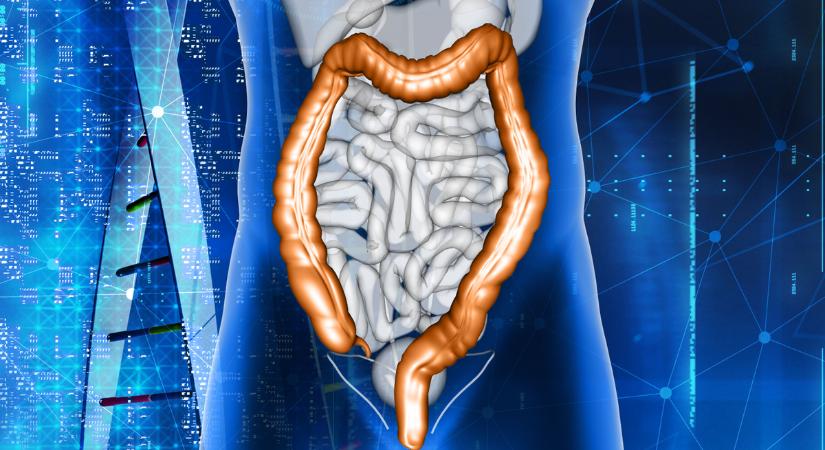 Március a vastagbélszűrés hónapja - erre hívják fel a figyelmet