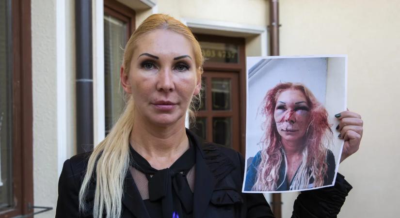 Nem fogja elhinni, mit üzent Orosz Bernadettnek a támadója