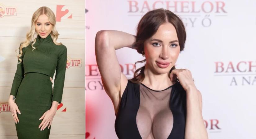 Újabb orrműtétre készül Kiara Lord: „Szedjenek ki maximálisan annyi szövetet, amennyit lehet”