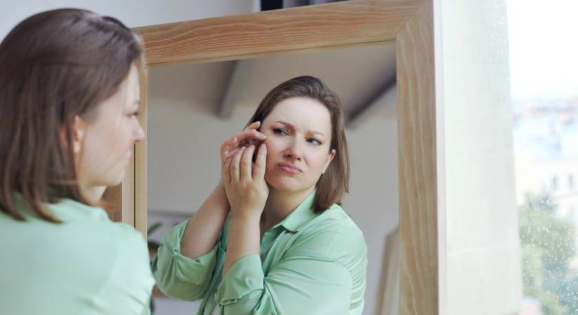 Ront a helyzeten, ha ezt teszed a gyulladt arcbőrrel: sokan nem tudják, mi állhat a háttérben