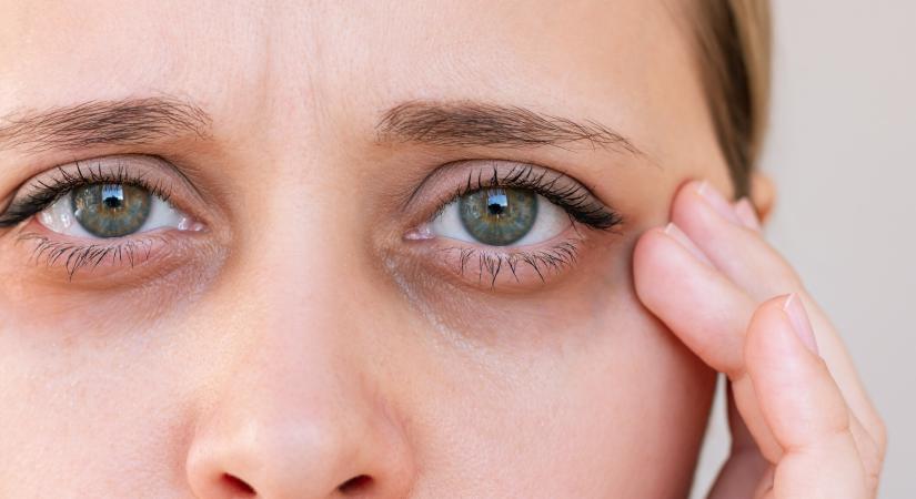 Apró pöttyöket vagy úszó szálakat látsz a szemed előtt? Ez állhat a háttérben