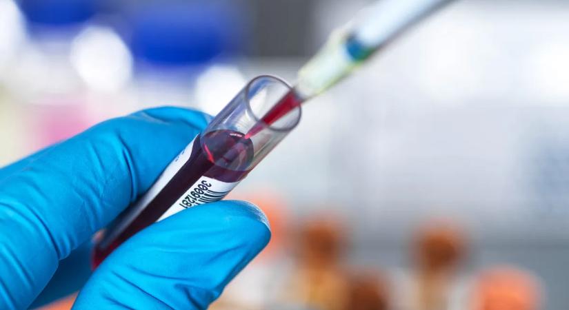 Veszélyben a férfiak: egy sima vérvétel lebuktatja a gyilkos kórt