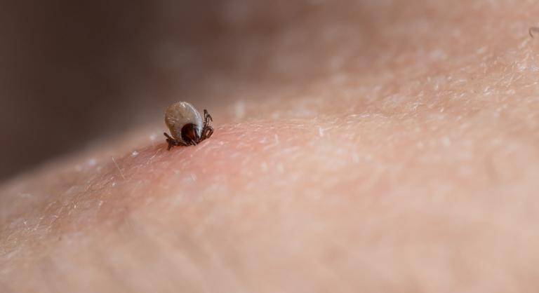 Halálos húsallergiát okozhat egy kullancscsípés, már igazolt halálesetek is vannak