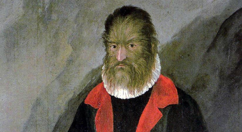 Pedro González volt a „farkasember”, akit kuriózumként hurcoltak végig Európa királyi udvarain