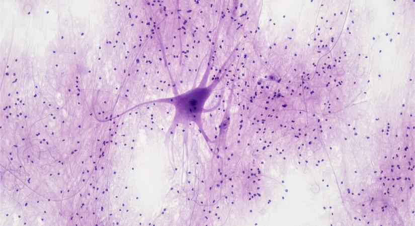 Így játszik Doomot kétszázezer mesterséges idegsejt