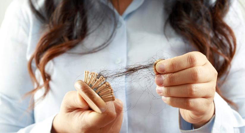 Így árulkodik a hajad a stressz-szintedről – 7 tünet, amit érdemes kezelni