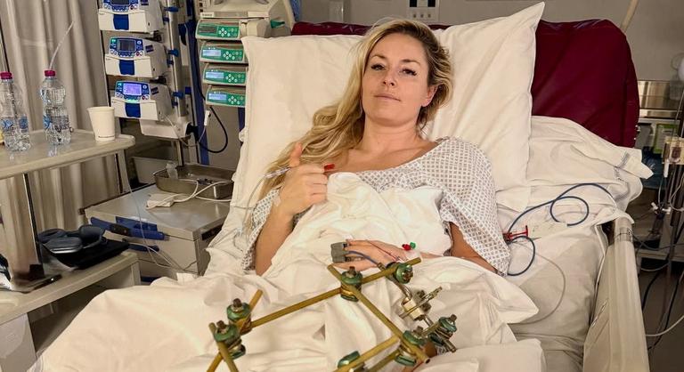 Így kénytelen közlekedni a legendás Lindsey Vonn öt műtétet követően – videó