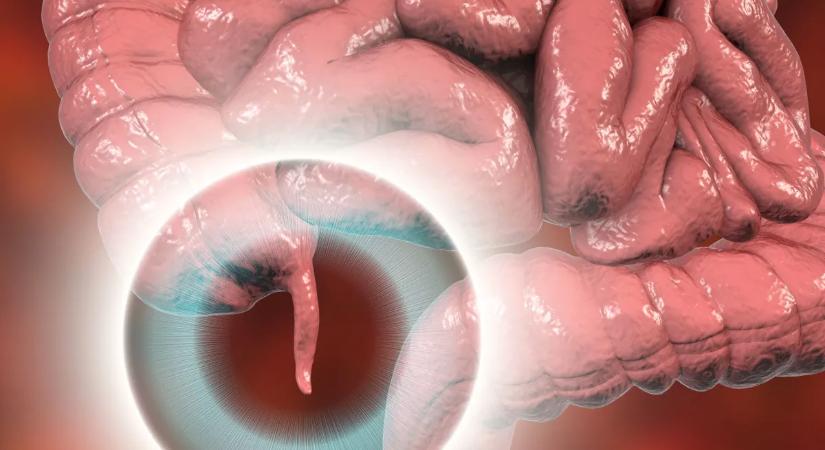 Súlyos tévedésben éltek az orvosok: kiderült, mi a vakbél valódi feladata