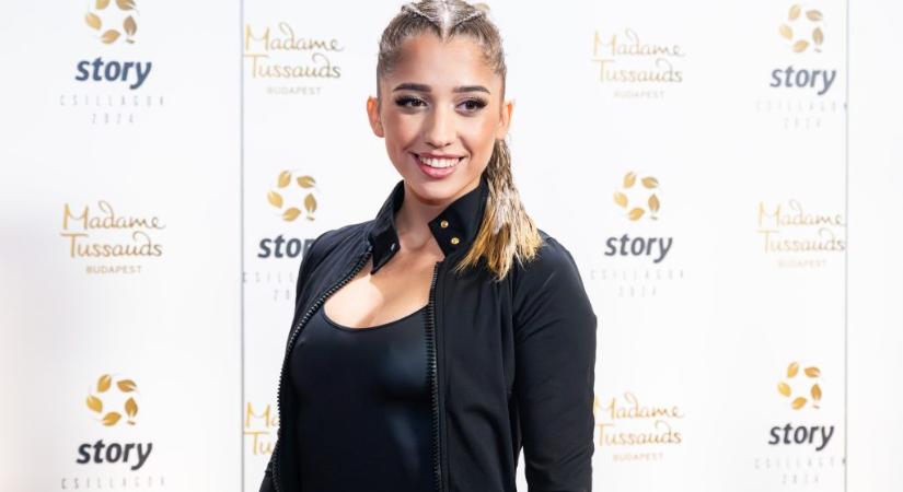 Schóbert Lara elmondta, milyen plasztikai beavatkozáson gondolkodik