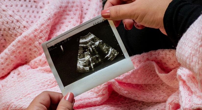 Vetélés után jött a bébibumm: négyesikrek születtek