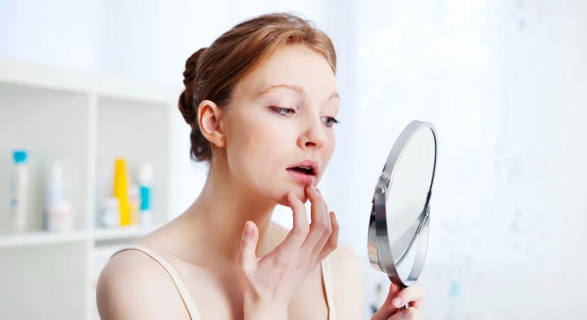 Ajakherpesz és visszatérő torokszorítás kínoz? Így támogasd a szervezeted a márciusi maradványtünetek ellen