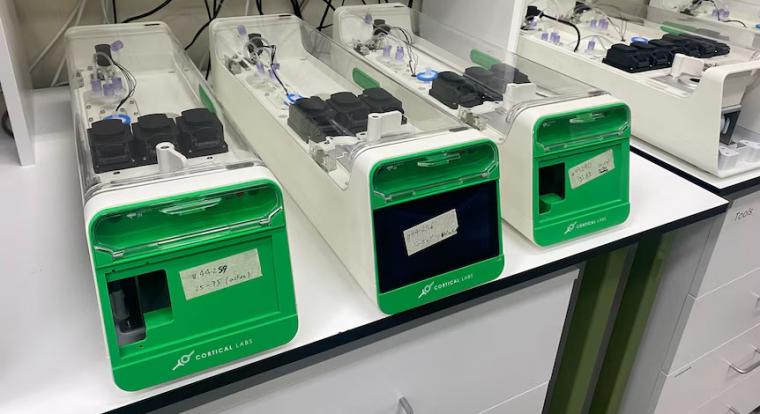 Emberi agysejtek hajtanak hamarosan két új adatközpontot