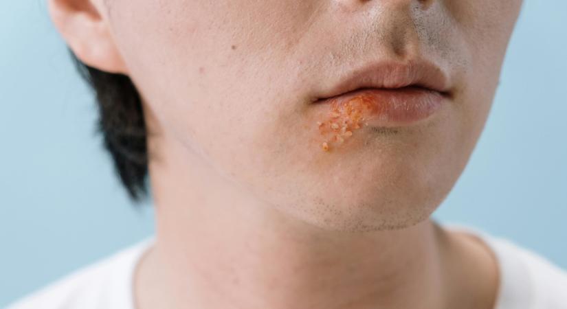 Márciusi maradványtünetek