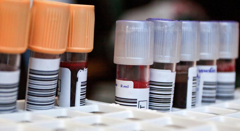 Ennél a vércsoportnál nagyobb a demencia rizikója