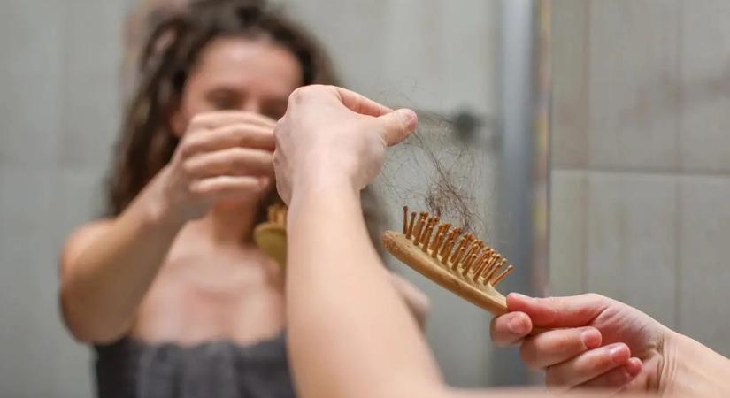 Ez a 4 változás a hajadon hormonális betegséget jelezhet