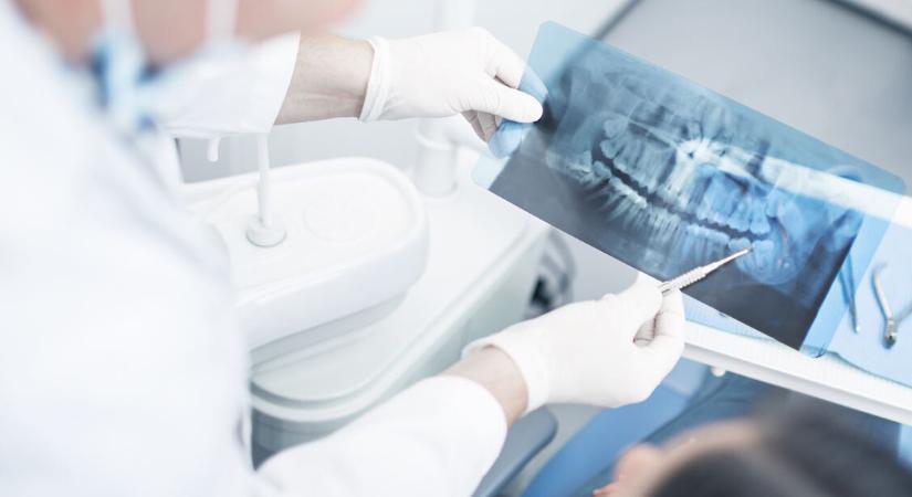 Guinness-rekord: ennek a férfinak van a legtöbb foga a világon – videó a számolásról