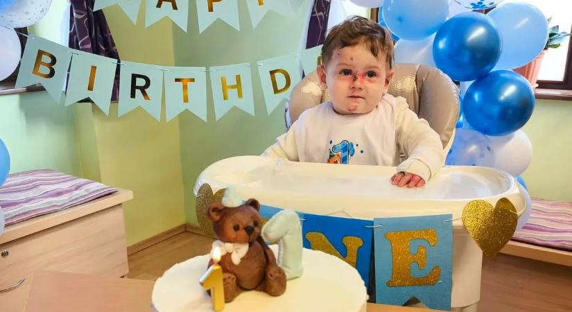 Egy éves lett a pillangóbőrrel küzdő Soma: „Hősiesen viseli minden pillanatát a betegségének”