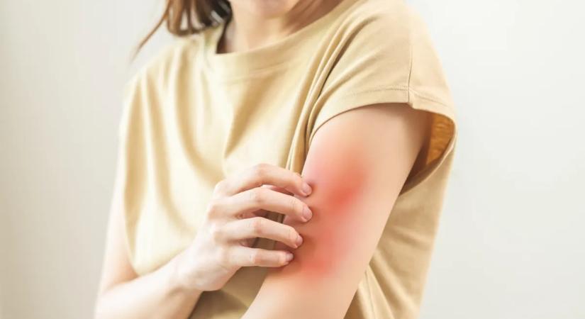 Valóban allergiásak lehetnek a nők a saját párjukra?