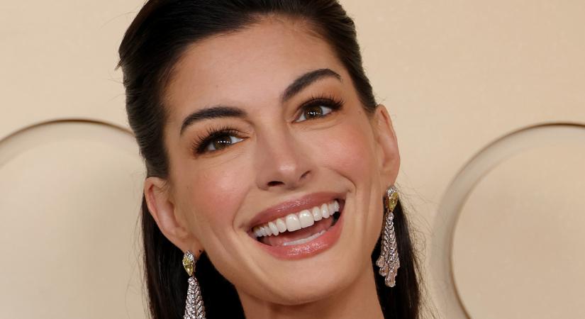 Akkor és most fotó: Anne Hathaway 12 év után lépett újra az Oscar-gála vörös szőnyegére - hihetetlen mennyit változott ennyi idő alatt