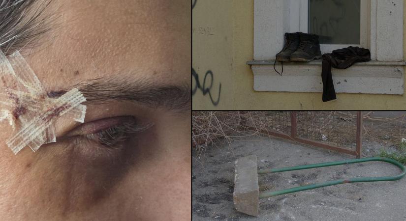 Vérfürdő a Huszár lakótelepen: Bottal zúzta szét ismerőse arcát a nyíregyházi támadó (fotókkal)