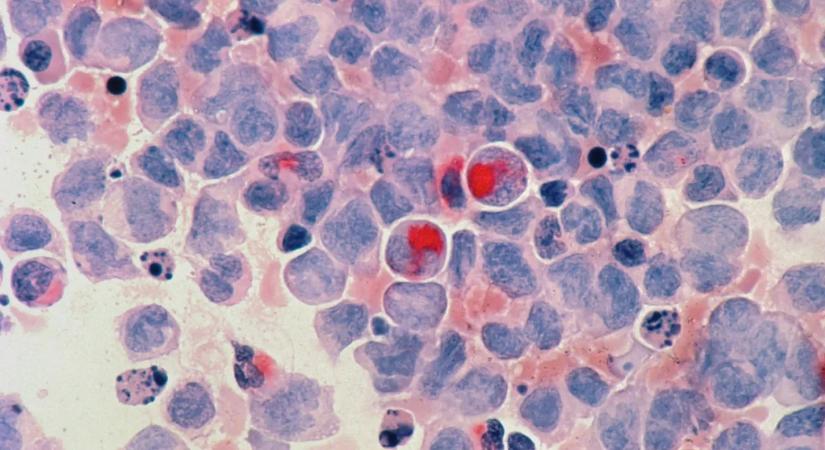 Hátborzongató, amit a rákról mondott a kutató – ez mindent megváltoztathat