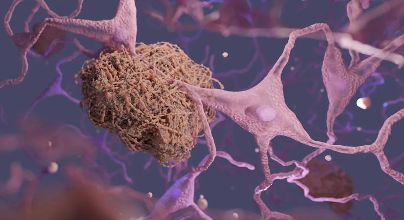 Egy egyszerű vérteszt évtizedekkel előre jelezheti a súlyos veszélyt