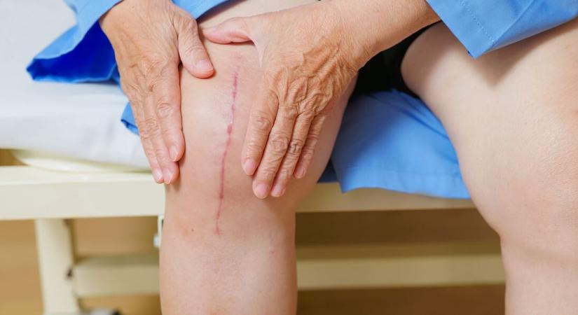 Orvosmeteorológia: a ma érkező hidegfront a régi műtétek helyén is okozhat panaszokat