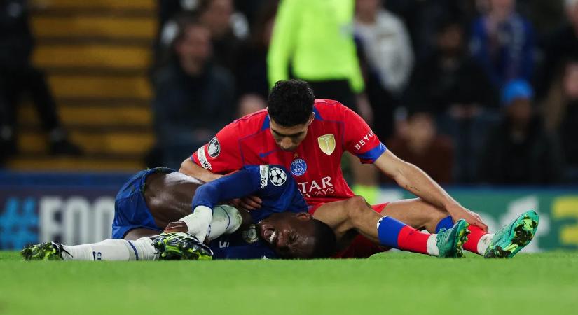 Nézni is rossz: brutális horrorsérülést szenvedett a Chelsea sztárja – fotó, videó