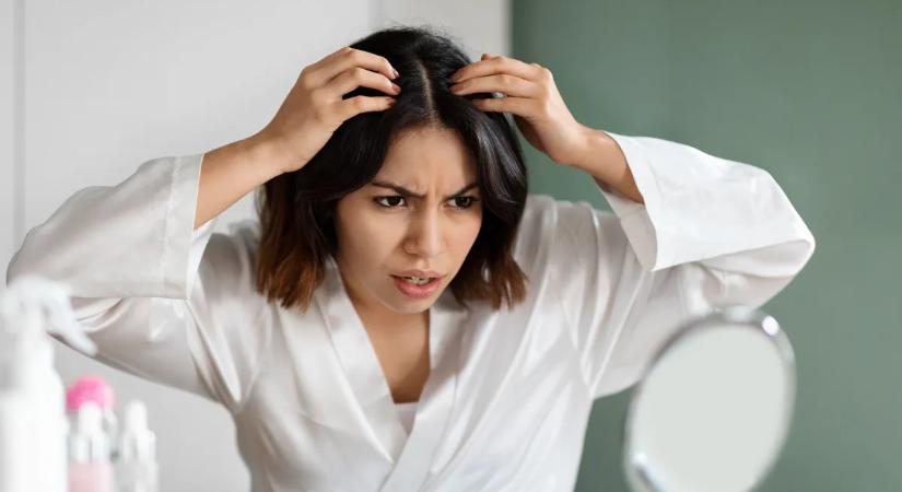 El szeretnéd tüntetni az ősz hajszálakat? Ezek a színek csodát tesznek a megjelenéseddel