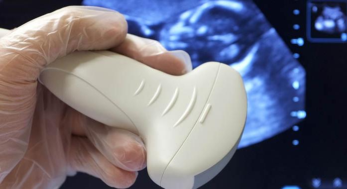 A kései gyermekvállalás kockázatai a baba egészsége szempontjából