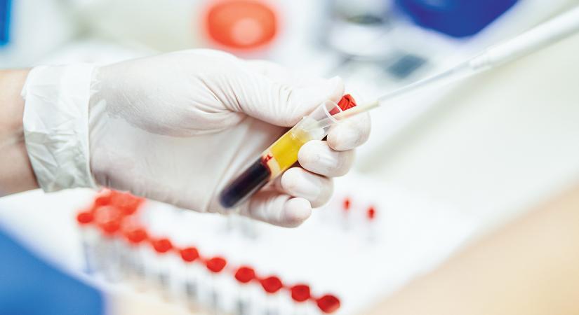 Keresetkiegészítés vagy  segítségnyújtás?  – Változtak a vérplazmaadás szabályai