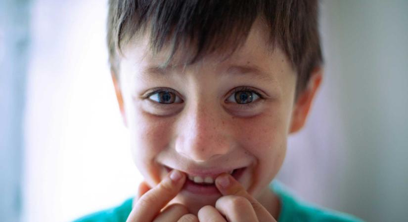 Rosszul állunk a szájhigiéniával: a gyermekek csupán 23 százalékának épek a tejfogai