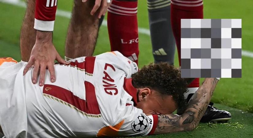 Horror Liverpoolban: levágta Lang ujját a reklámtábla