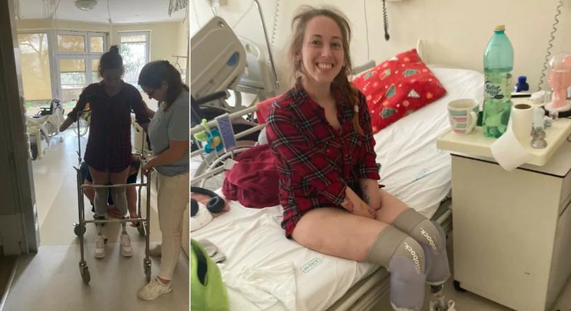 Amputáció után újratanul járni a szép fodrászlány: Fanni megkapta a műlábakat!