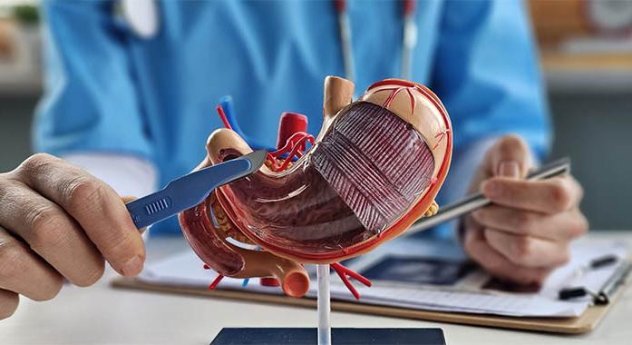 Gyomorrezekció (gyomoreltávolítás)