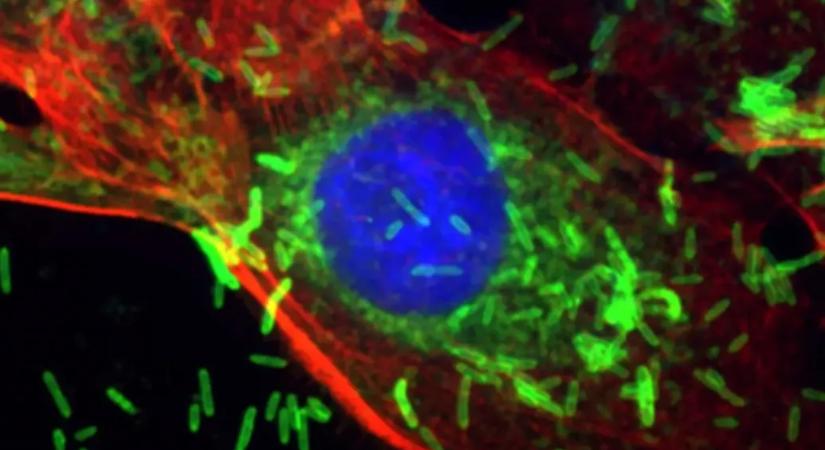 Egy ínybetegséget okozó baktérium segítheti a mellrák kialakulását