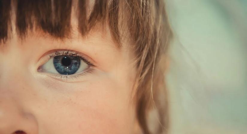 Ha ezt látja gyermeke szemén, ne várjon – azonnal orvos kell!